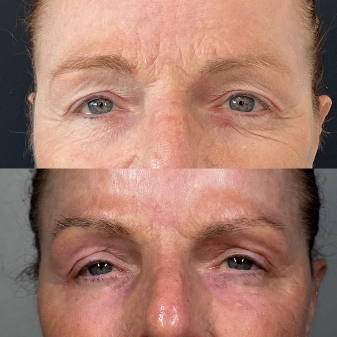 Antes e depois — Clínica Fischer