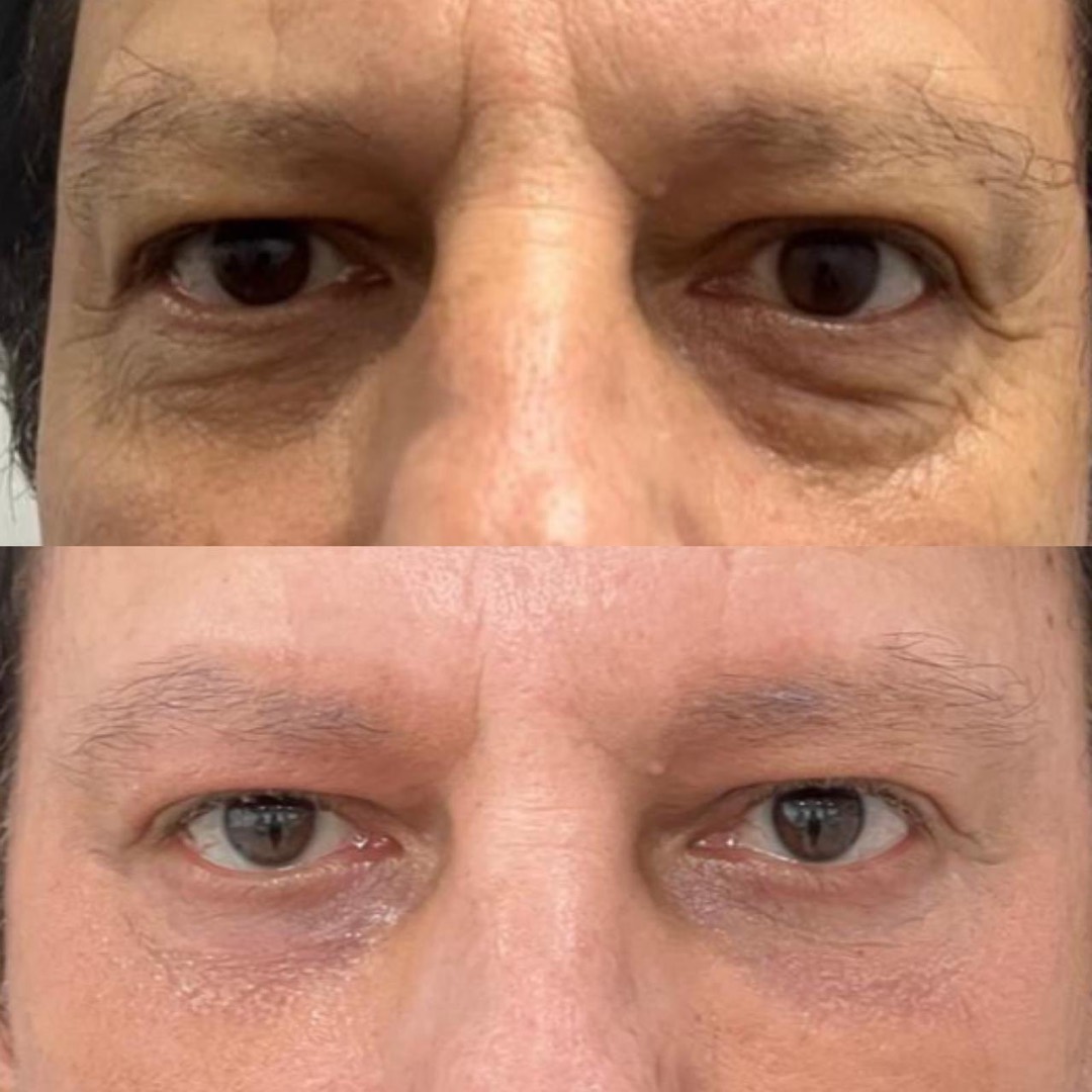 Antes e depois — Clínica Fischer